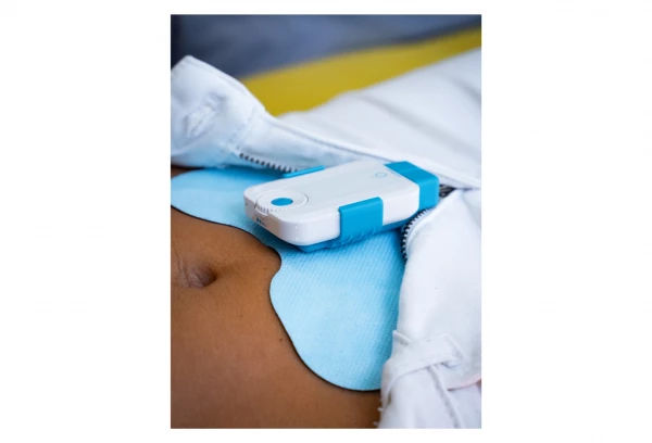 Pack De 3 Electrodes Papillon BLUETENS 4 Pack De 3 Electrodes Papillon BLUETENS – Image 4